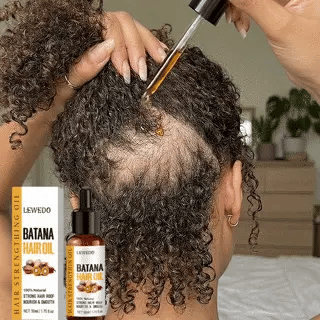 Huile de Batana™ 100% pure | Sérum de croissance des cheveux, pour tous les types de cheveux